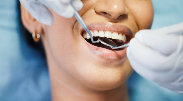 Best Chipped Tooth Repair Near Me  in Pendleton, OR